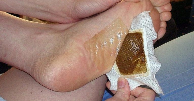 How To Make Detox Foot Pads At Home To Cleanse Your Body Of Toxins