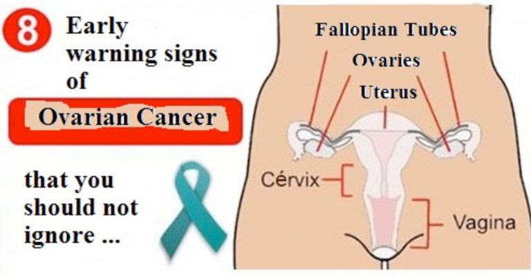 Early Signs and Symptoms of Ovarian Cancer You Should Know