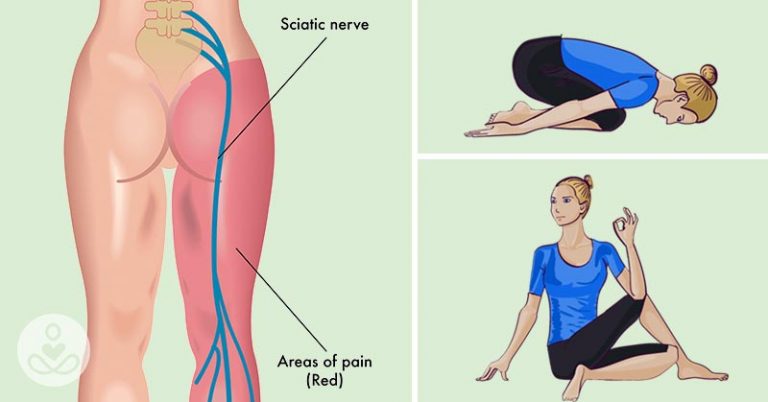 8 EASY YOGA POSES TO HELP RELIEVE SCIATICA AND LOWER BACK PAIN IN 30 MINUTES