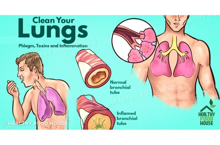 HOW TO GET RID OF PHLEGM AND MUCUS IN CHEST & THROAT (INSTANT RESULT)
