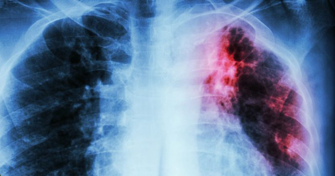 THE LUNG-CLEANSING DRINK THAT ANYONE WHO SMOKES OR WHO HAS EVER SMOKED NEEDS TO TRY