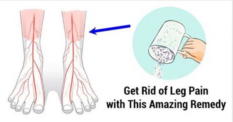 THE 10 BEST HOME REMEDIES FOR YOUR LEG PAIN