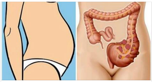 THE REAL REASON WHY YOUR STOMACH IS BLOATED AND HOW TO FIX IT
