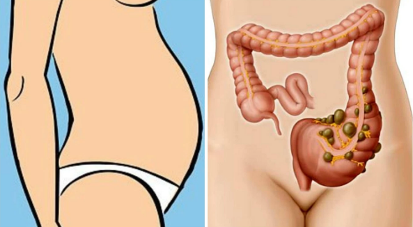 THIS IS WHY YOU HAVE BLOATED STOMACH AND HOW TO GET RID OF BLOATING AND LOSE WEIGHT OVERNIGHT!