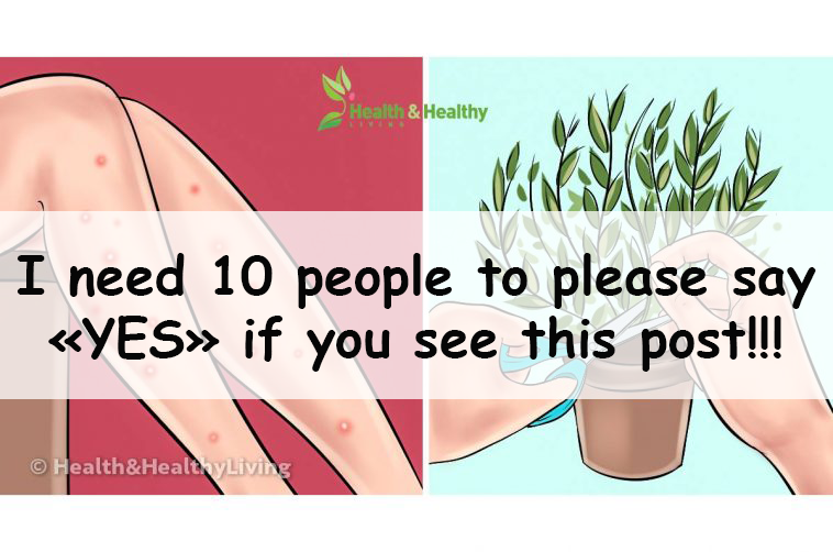 THIS IS WHY MOSQUITOES BITE YOU MORE AND WHAT YOU NEED TO DO TO REPEL THEM NATURALLY