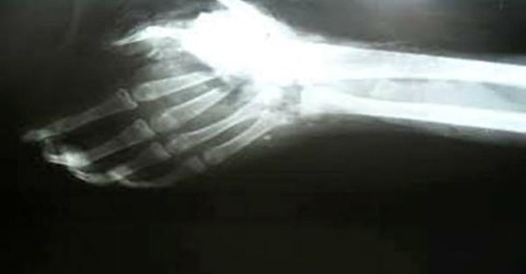 24 FACTS ABOUT LEFT-HANDED PEOPLE THAT YOU DIDN’T KNOW ABOUT