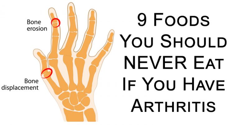9 FOODS YOU SHOULD NEVER EAT IF YOU HAVE ARTHRITIS