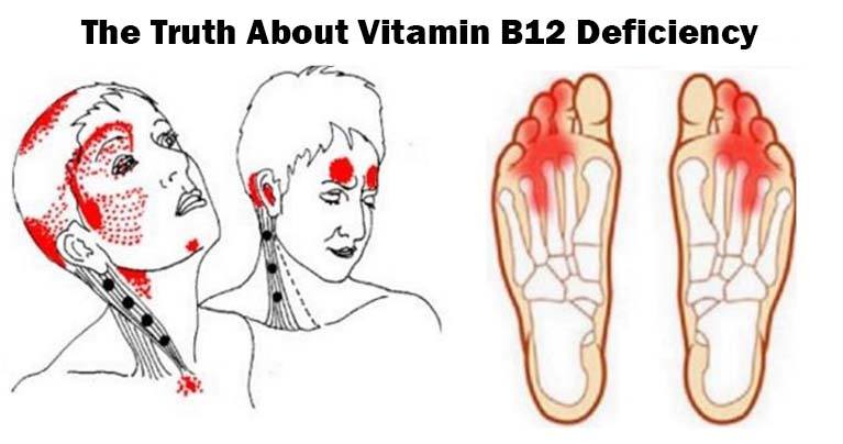 GIVE ME 10 MINUTES, I’LL GIVE YOU THE TRUTH ABOUT VITAMIN B12 DEFICIENCY