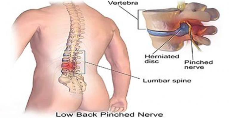 THE SECRET TO BACK PAIN IS IN YOUR FEET! THE 5 EXERCISES THAT FIX EVERYTHING!