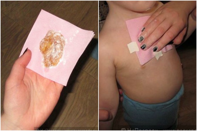 WRAPPED GINGER – TREATS BAD COUGH AND REMOVES MUCUS FROM THE LUNGS IN ONE NIGHT!