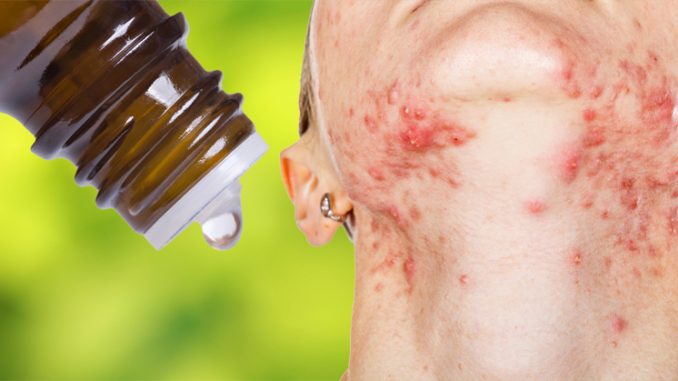 7 ESSENTIAL OILS THAT BALANCE HORMONES & HOW TO USE THEM