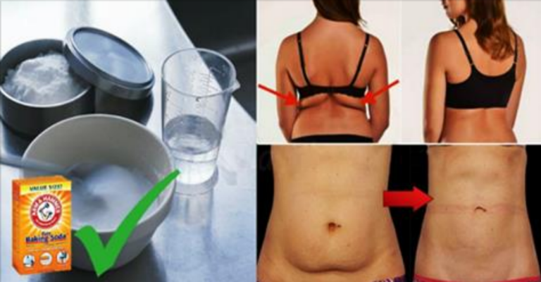 THIS IS THE CORRECT WAY TO USE BAKING SODA TO BURN FAT FROM YOUR BACK, ARMS, THIGHS AND BELLY