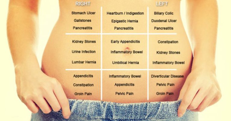 USE THIS ‘BELLY MAP’ TO FIND OUT WHAT’S MAKING YOUR STOMACH HURT
