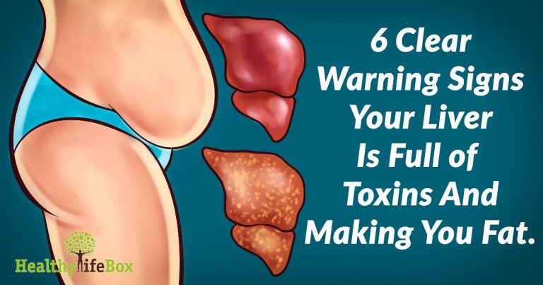 6 SIGNS THAT YOUR LIVER IS FULL OF TOXINS AND MAKING YOU FAT (AND HOW TO STOP IT)