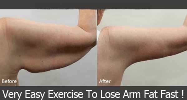 BEST EXERCISES TO LOSE ARM FAT VERY FAST