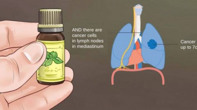 THE TRUTH ABOUT CANCER AND ESSENTIAL OILS WHAT NO ONCOLOGIST WILL TELL YOU