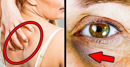 12 SIGNS YOU’RE EATING TOO MUCH SUGAR