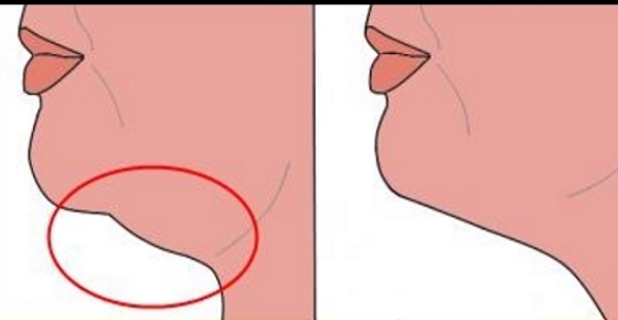 QUICK AND EASY EXERCISES TO GET RID OF A DOUBLE CHIN