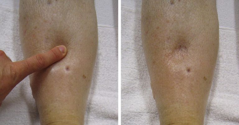 IF YOU TEST POSITIVE ON ANY OF THESE 10 AT-HOME TESTS, GO SEE YOUR DOCTOR IMMEDIATELY!