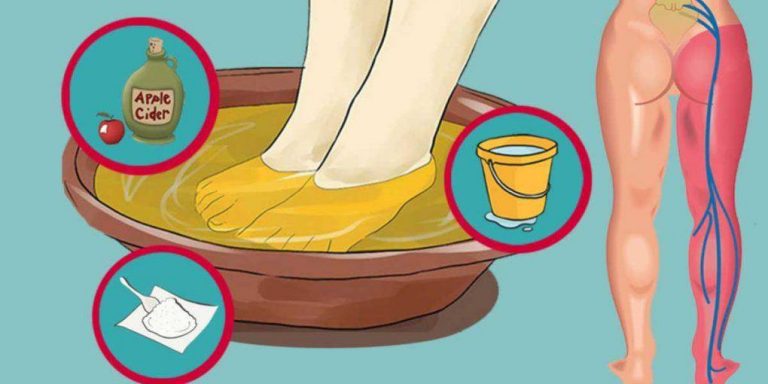 TRY THIS SIMPLE AND EFFECTIVE METHOD AND SAY GOODBYE TO SCIATIC NERVE PAIN