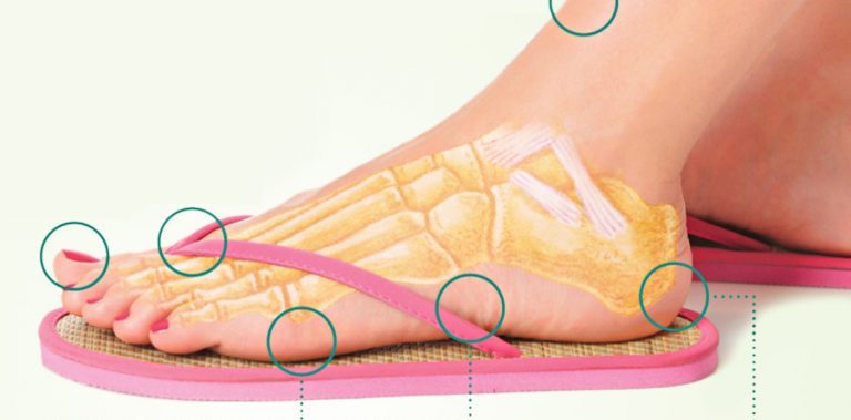 5 Ways Wearing Flip Flops Destroys Your Health Without You Noticing