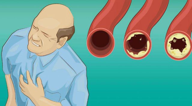 12 Foods that You Should Eat Daily for Clean Arteries