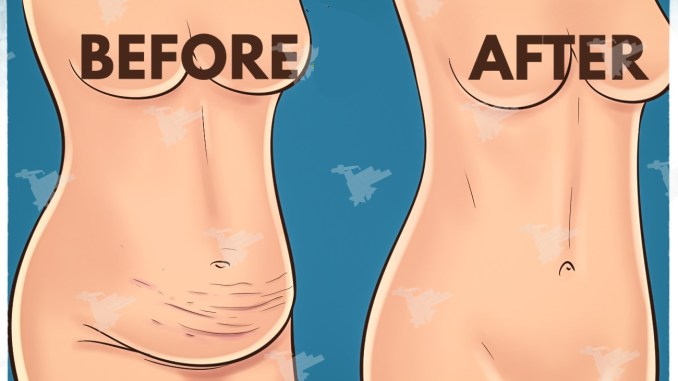 Consume This Mixture For 4 Days and Lose Up To 4 Kg / 16 Cm Waist. Amazing!