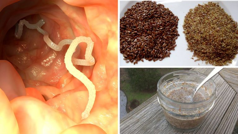 10 Warning Signs Your Body is Full of Parasites and 7 Foods That Can Help Kill Them