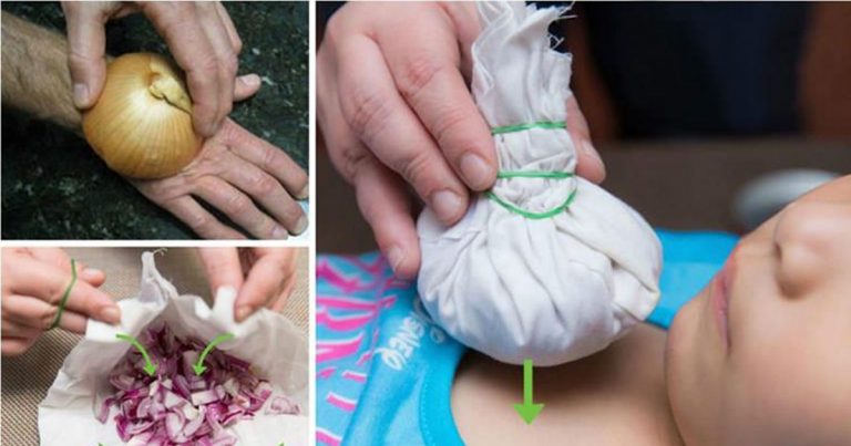 Onions Are A Great Natural Remedy For Common Illnesses – Here Are 12 Unexpected Ways To Use Them