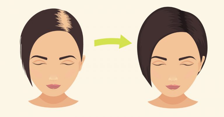 Baking Soda Stops Hair Loss & Promotes Hair Growth In No Time!