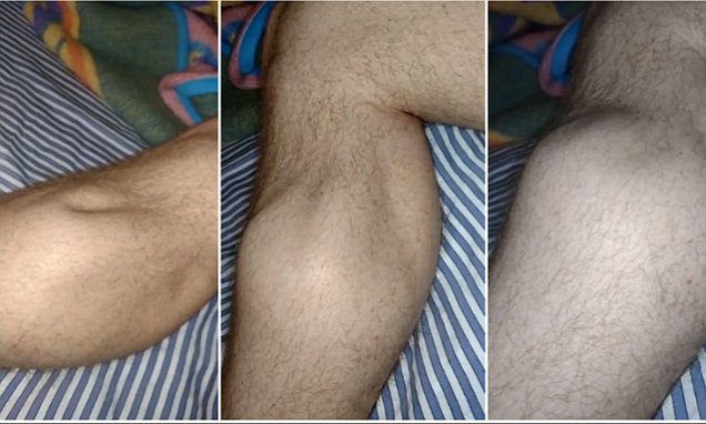 This Is Why Your Legs Cramp At Night (And How to Stop It From Happening Ever Again)