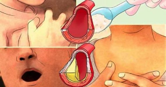 My Cardiologist Unclogged My Arteries and Removed the High Blood Pressure With Just 4 Tablespoons