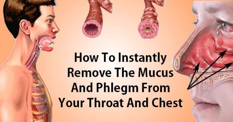 How to Get Rid of Phlegm and Mucus in Chest & Throat (Instant Result)