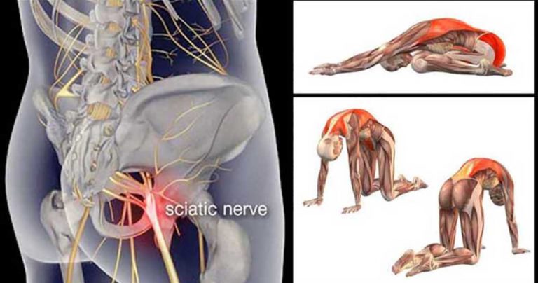 10 Piriformis Stretches to Get Rid of Sciatica, Hip, and Lower Back Pain