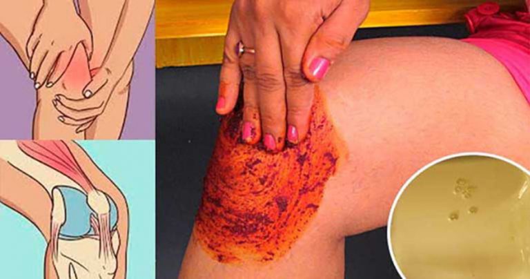 People Go Crazy For This Recipe! It Heals Knee, Bone and Joint Pain