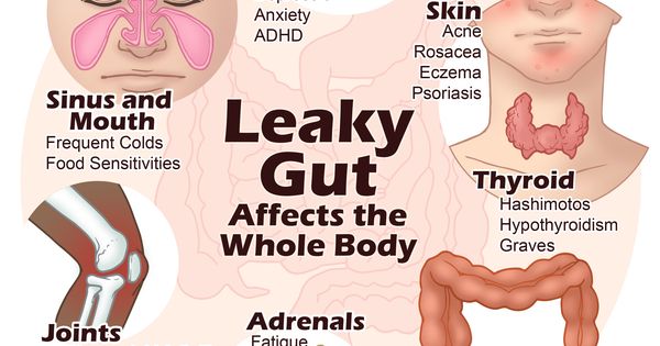 4 Steps to Heal Leaky Gut and Autoimmune Disease