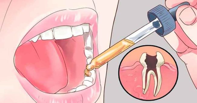 12 All Natural Toothache Remedies Your Dentist Doesn’t Want You to Know About