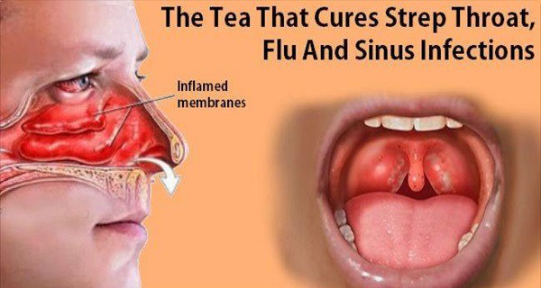 The Tea That Cures Strep Throat, Flu And Sinus Infections