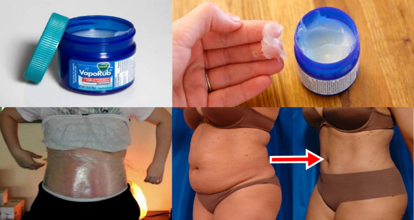 Here are amazing uses of Vicks