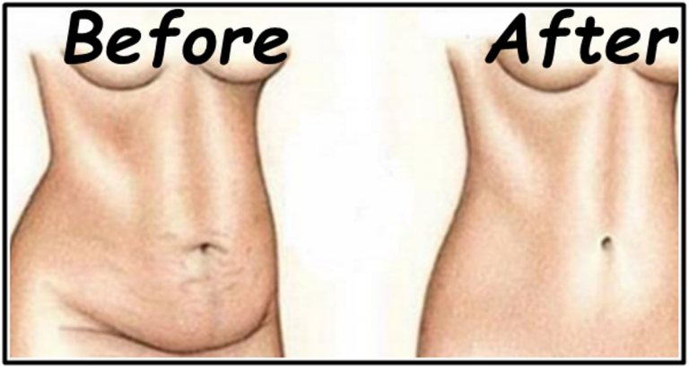 Mixture Helped a lot of People To Lose 7 pounds In 4 Days