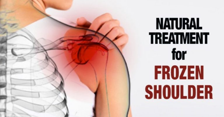 Natural Treatment for Frozen Shoulder and Be Healed Within Days!