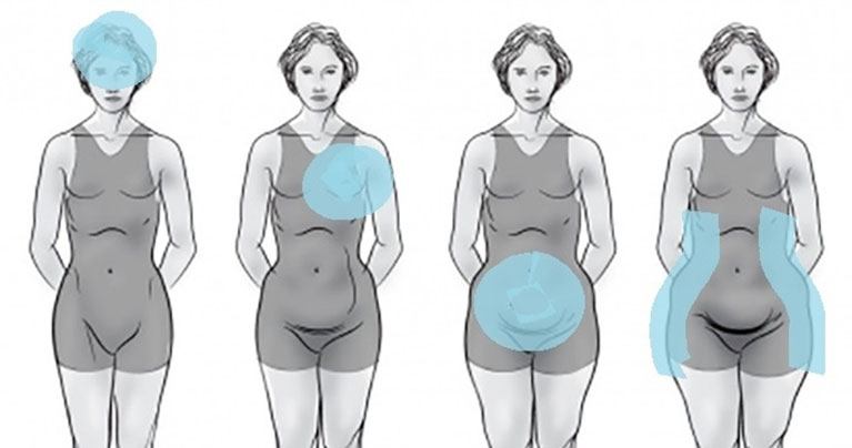 Don’t Ignore These 6 Signs of a Hormonal Imbalance