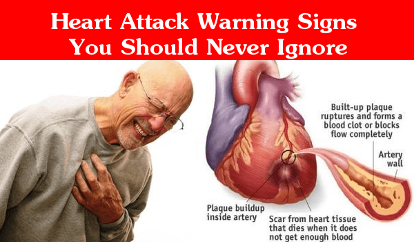 Heart Attack Symptoms Warning Signs you Should Never Ignore